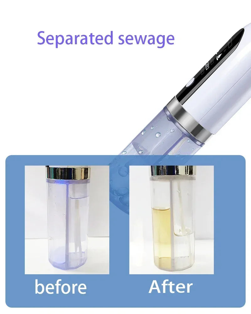 Pore Vacuum Cleaner Upgraded Blackhead Vacuum Rechargeable Face Vacuum Comedone Extractor Tool For Blackhead