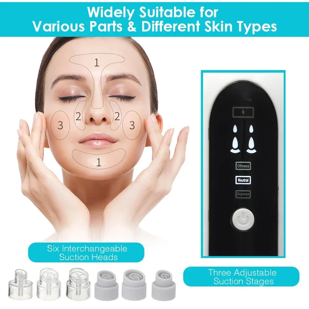 Pore Vacuum Cleaner Upgraded Blackhead Vacuum Rechargeable Face Vacuum Comedone Extractor Tool For Blackhead