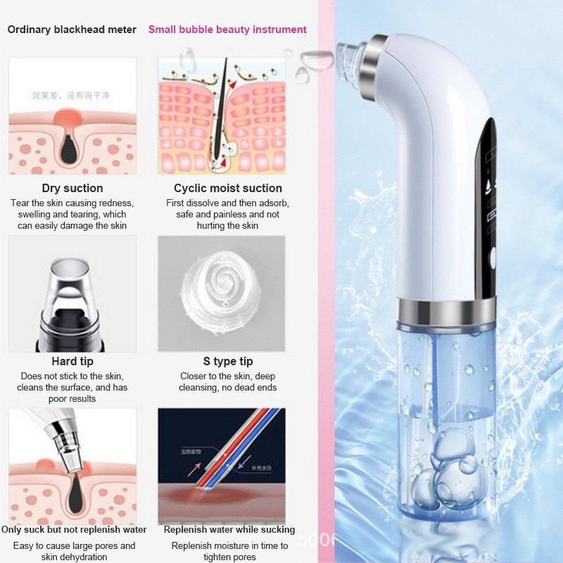 Pore Vacuum Cleaner Upgraded Blackhead Vacuum Rechargeable Face Vacuum Comedone Extractor Tool For Blackhead