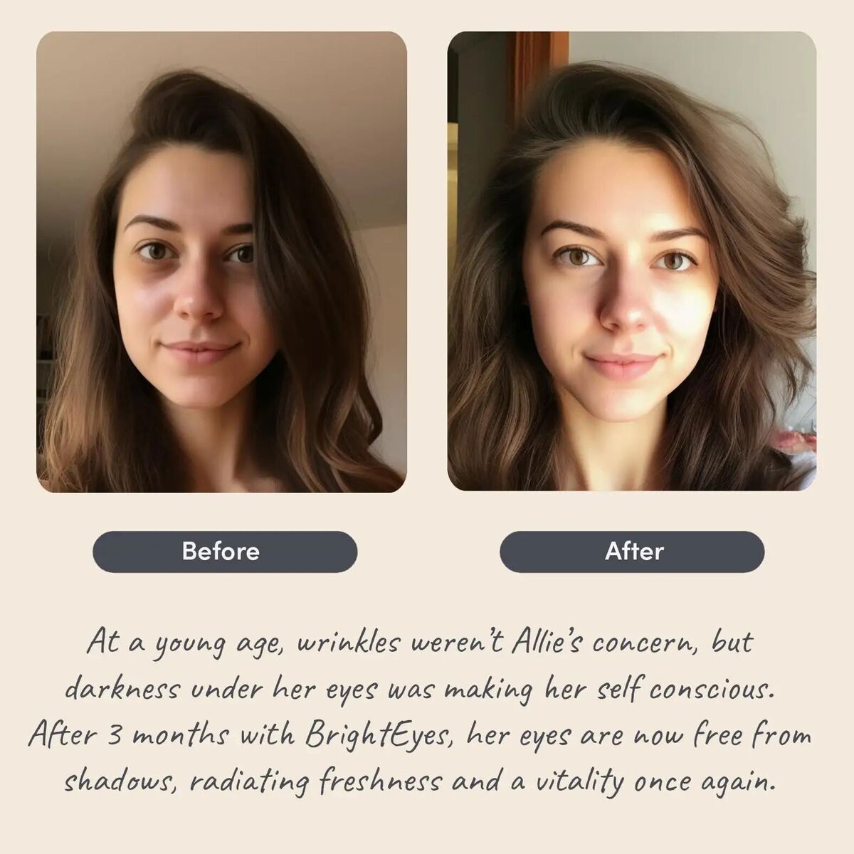 Soothing Remover Eye Bags Eye Massager