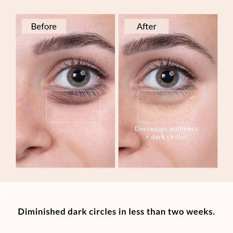 Soothing Remover Eye Bags Eye Massager